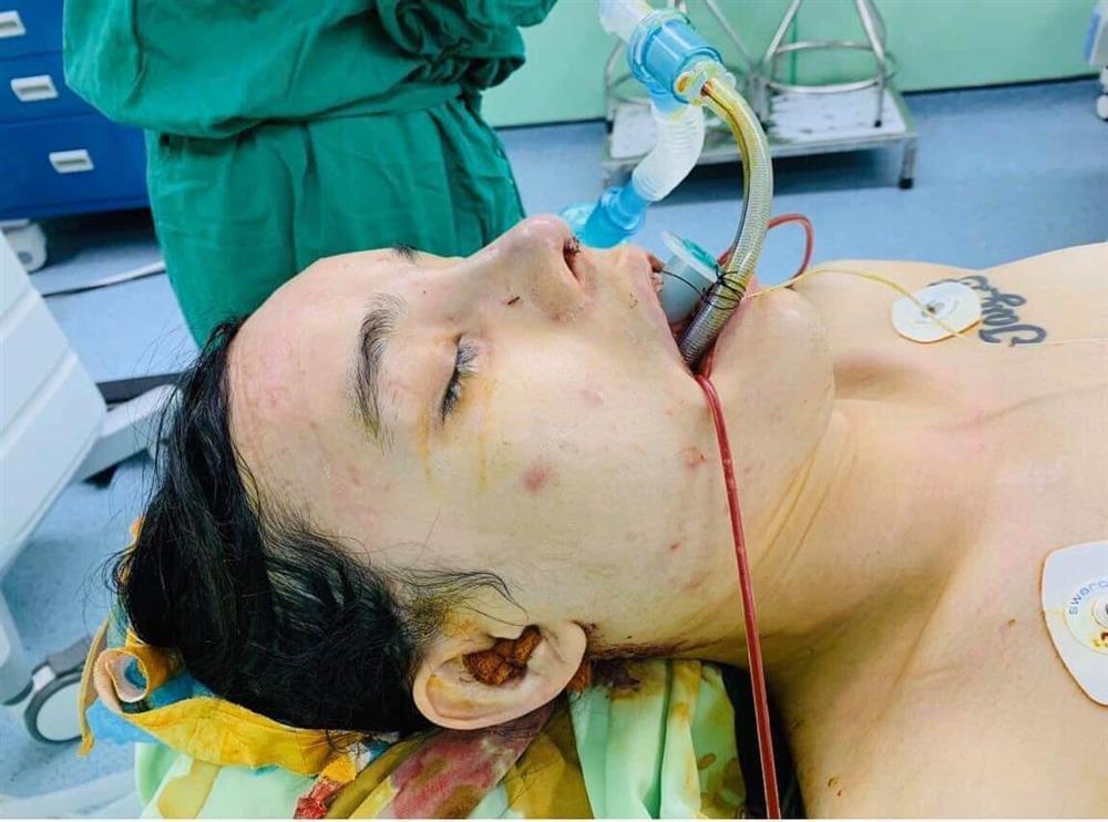 Mất 500 triệu chuyển giới, chàng trai biến hình visual nuột hơn gái duột-4