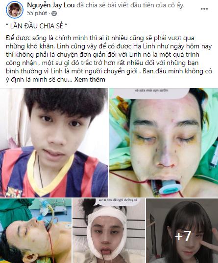 Mất 500 triệu chuyển giới, chàng trai biến hình visual nuột hơn gái duột-1