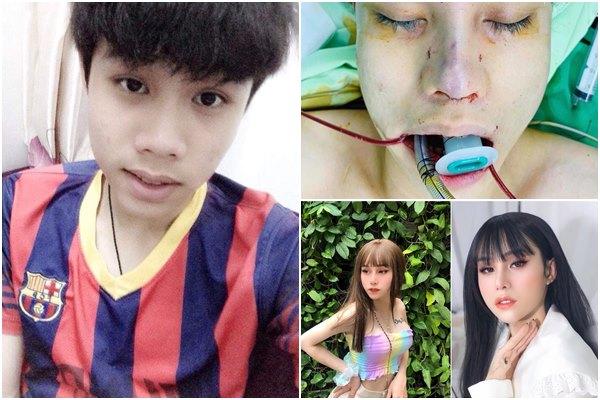 Hết hồn quy trình độn bắp chân silicon dành cho người cẳng gà-11