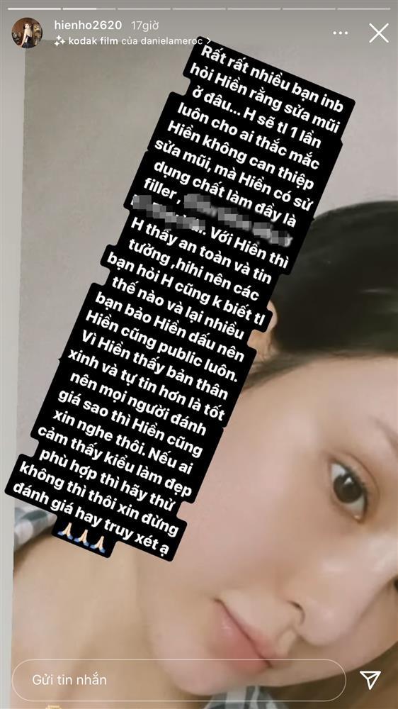 Hiền Hồ nói về chiếc mũi dao kéo: Không cắt gọt, đẹp nhờ thủ thuật!-3