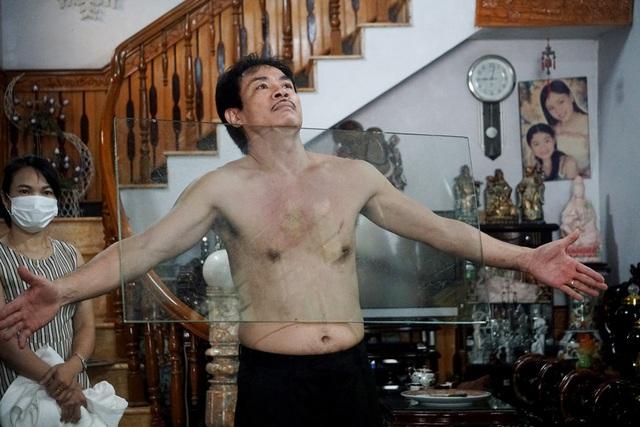 Chuyện lạ: Dị nhân Thanh Hóa như nam châm khổng lồ, hút đồ vật dính chặt cơ thể-3