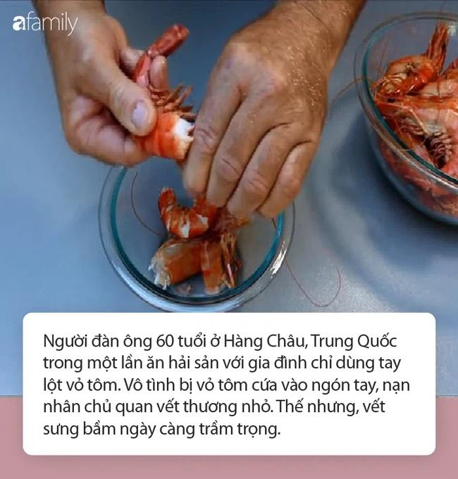 Chỉ làm duy nhất việc này trước khi ăn tôm và người đàn ông tử vong-2