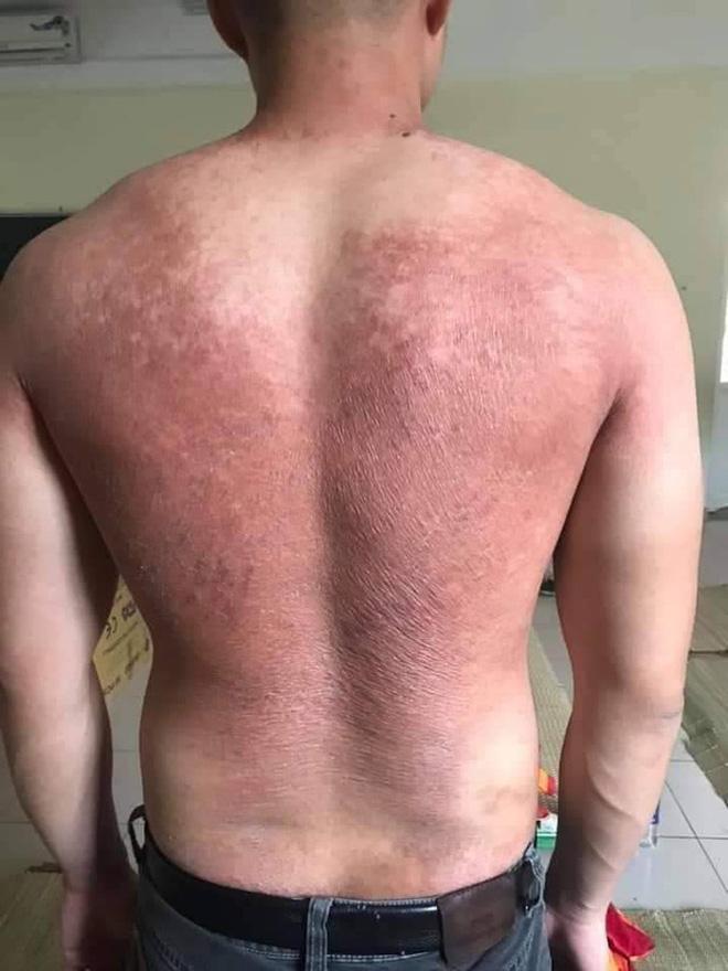 Mặc nắng nóng kinh hoàng, y bác sĩ vẫn nhảy múa lạc quan giữa tâm dịch Bắc Giang-2