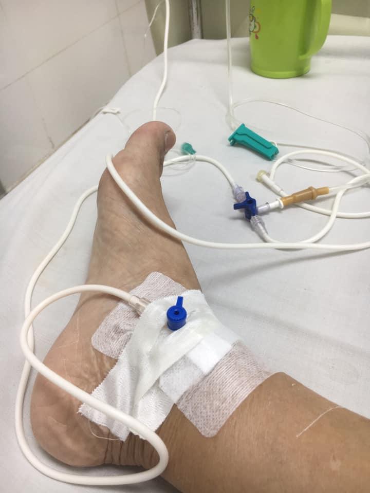 Giang Còi lạc quan dù bệnh nặng, phải lấy ven chân vì tay sưng to bầm tím-3