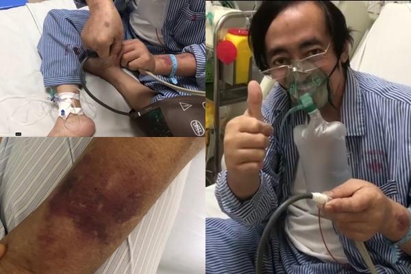 Giang Còi nói về bệnh tình: Thần chết luôn rập rình ở cửa-5