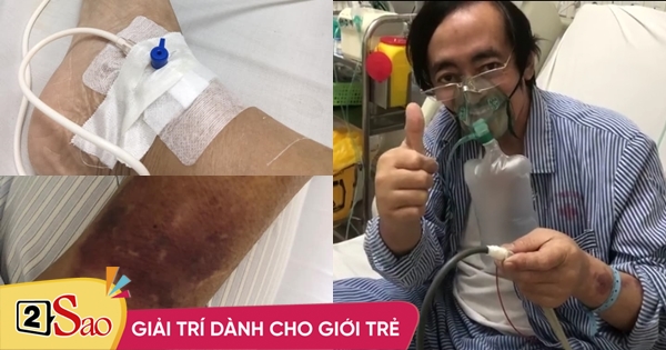 Giang Còi lạc quan dù bệnh tình nặng sụt 14 kg