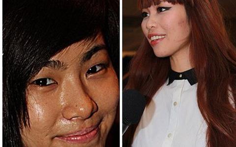 Mụn đầu đen mọc tái mọc hồi ở mũi, đâu là nguyên nhân và cách khắc phục-2