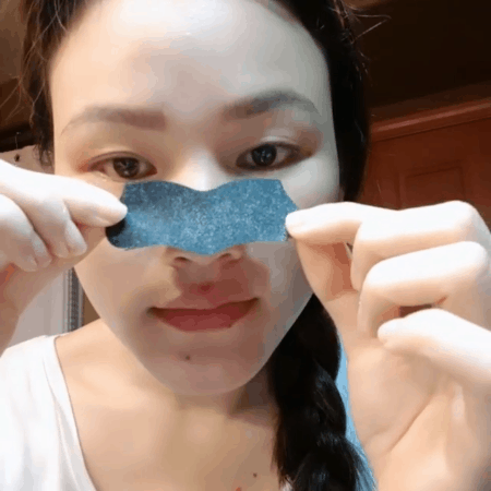 Mụn đầu đen mọc tái mọc hồi ở mũi, đâu là nguyên nhân và cách khắc phục-6