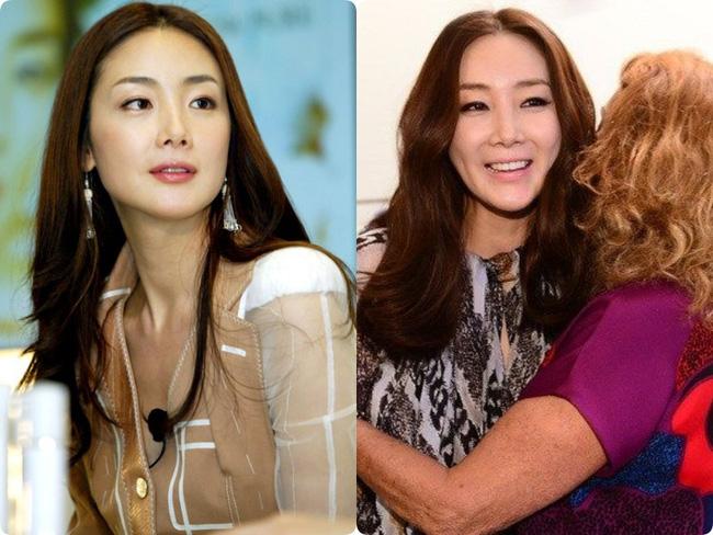 Người đẹp khóc Choi Ji Woo: Từng có giai đoạn mặt sưng phù cứng đơ vì tiêm Botox-3