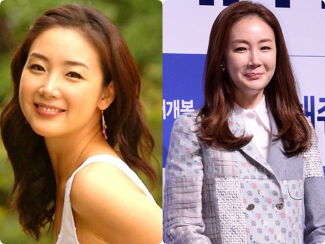 Người đẹp khóc Choi Ji Woo: Từng có giai đoạn mặt sưng phù cứng đơ vì tiêm Botox-5