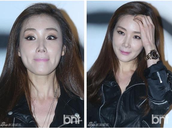 Người đẹp khóc Choi Ji Woo: Từng có giai đoạn mặt sưng phù cứng đơ vì tiêm Botox-6