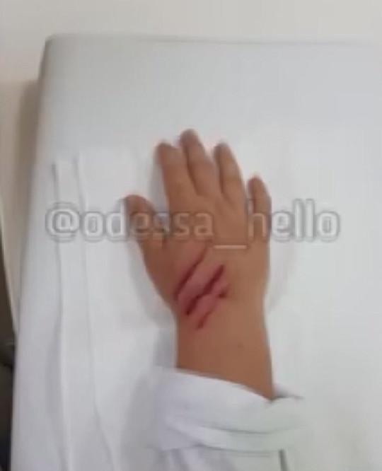 Clip: Giơ tay định cưng nựng cá heo, cậu bé 6 tuổi bị ngoạm nguyên bàn tay-1