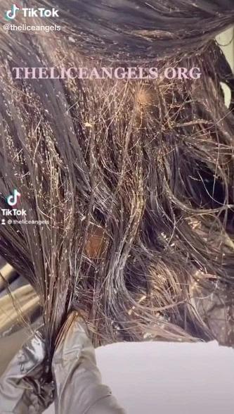 Sởn da gà kinh hãi với clip diệt tổ chấy nghìn con trên đầu bé gái-1