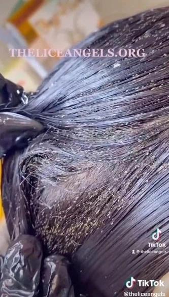 Sởn da gà kinh hãi với clip diệt tổ chấy nghìn con trên đầu bé gái-2