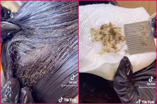'Sởn da gà' kinh hãi với clip diệt tổ chấy nghìn con trên đầu bé gái