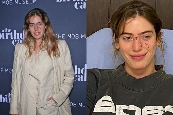 Tài tử xứ Hàn chịu quản chế vì để chó cưng cắn chết người-2