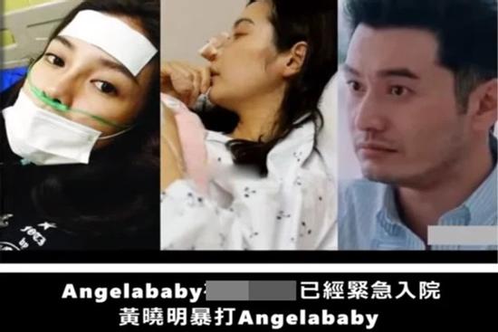 Rộ tin Angela Baby bị Huỳnh Hiểu Minh đánh đập tới mức nhập viện