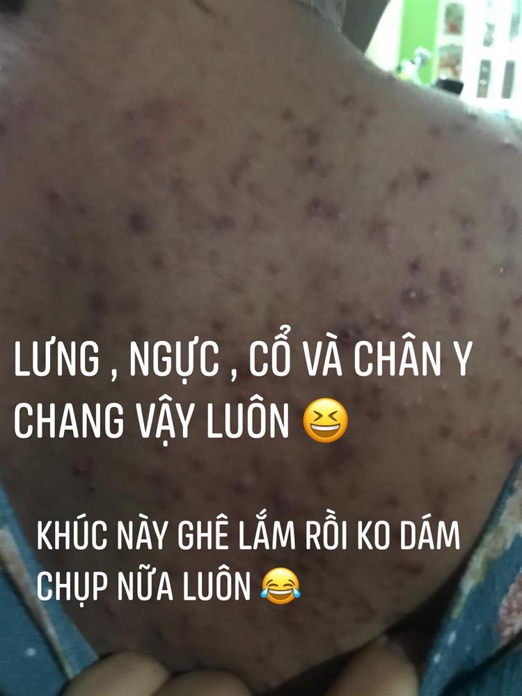 Đặng Thu Thảo trước sinh mặt đầy mụn, sau sinh như vẫn bầu-2