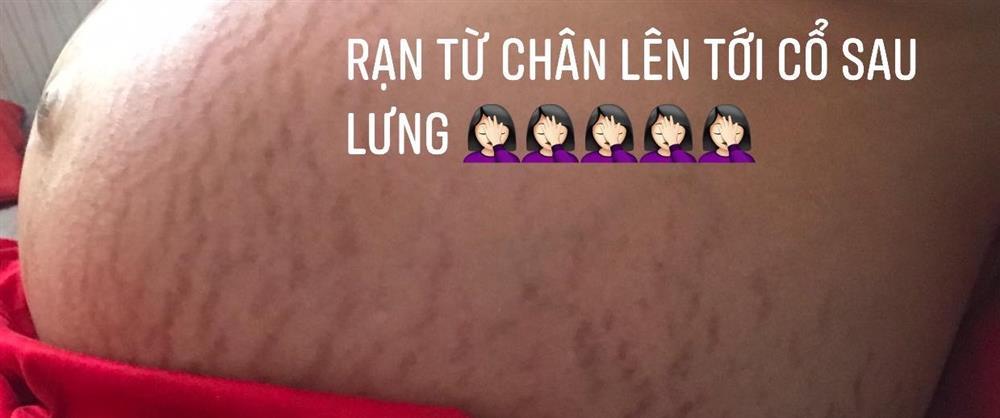 Đặng Thu Thảo trước sinh mặt đầy mụn, sau sinh như vẫn bầu-3