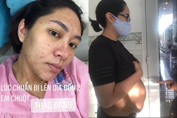 Hoa hậu Đặng Thu Thảo thừa nhận phẫu thuật thẩm mỹ-13