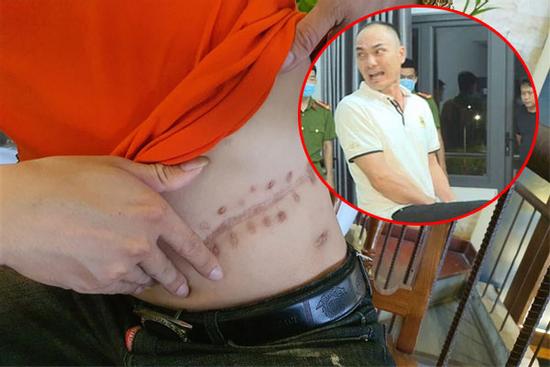Nợ hơn 4 tỷ, người đàn ông bị nhốt, dọa mang ra nước ngoài cắt thận