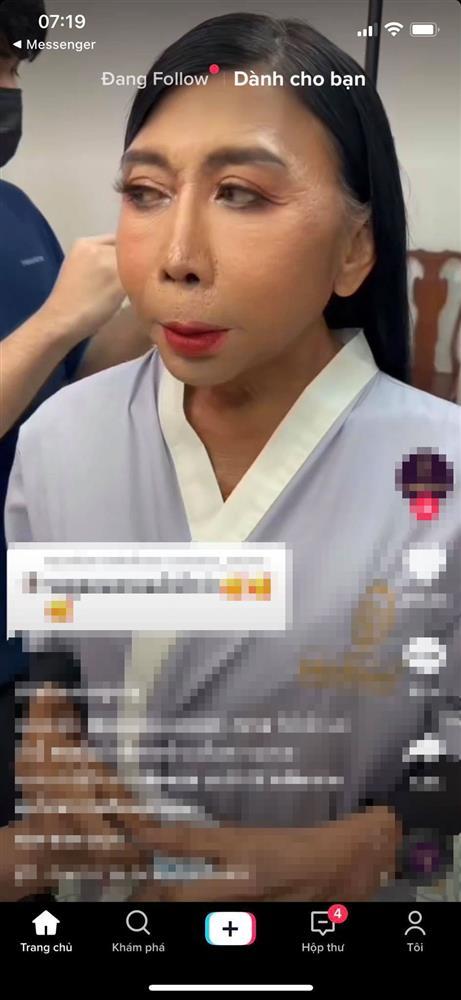 Gái già chuyển giới khoe hình sau dao kéo, nhìn mặt giật mình-2