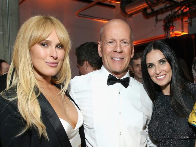 Rumer Willis là hậu duệ của 2 diễn viên nổi tiếng Bruce Willis và Demi Moore. Cô từng xuất hiện cùng cha trong 