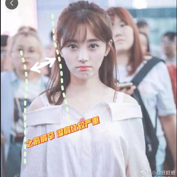 Mỹ nhân 4000 năm Cúc Tịnh Y bị tố phẫu thuật chỉnh vai-1