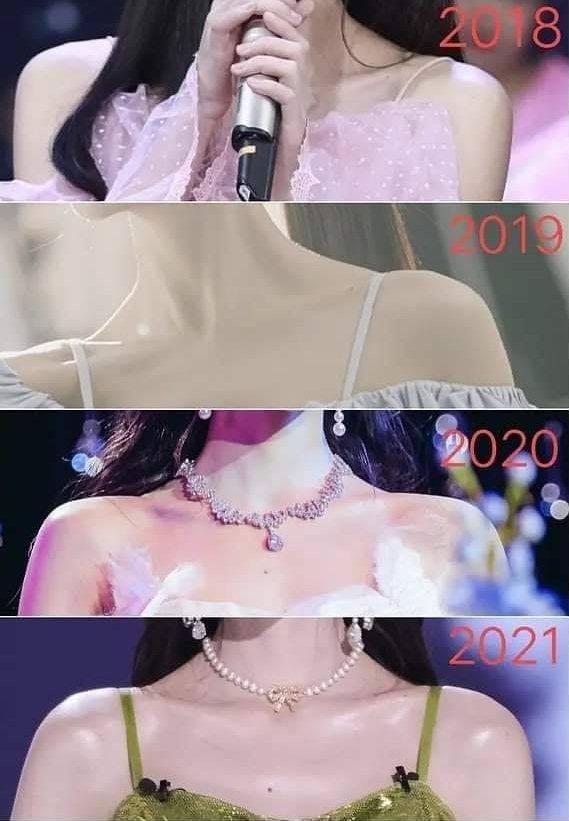 Mỹ nhân 4000 năm Cúc Tịnh Y bị tố phẫu thuật chỉnh vai-4