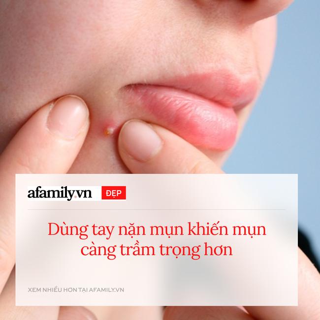 CẢNH BÁO: 8 bước skincare tưởng tốt nhưng lại càng khiến da xấu tệ hại-5