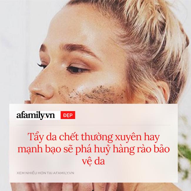 CẢNH BÁO: 8 bước skincare tưởng tốt nhưng lại càng khiến da xấu tệ hại-6