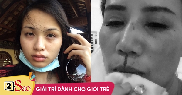 Diễn viên Hoàng Yến và loạt sao nữ bị bạo hành