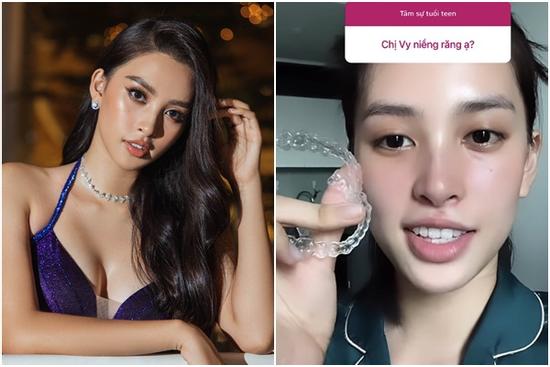 Xinh đẹp không tì vết, Tiểu Vy thú nhận vẫn đang 'sửa' 1 điểm trên mặt