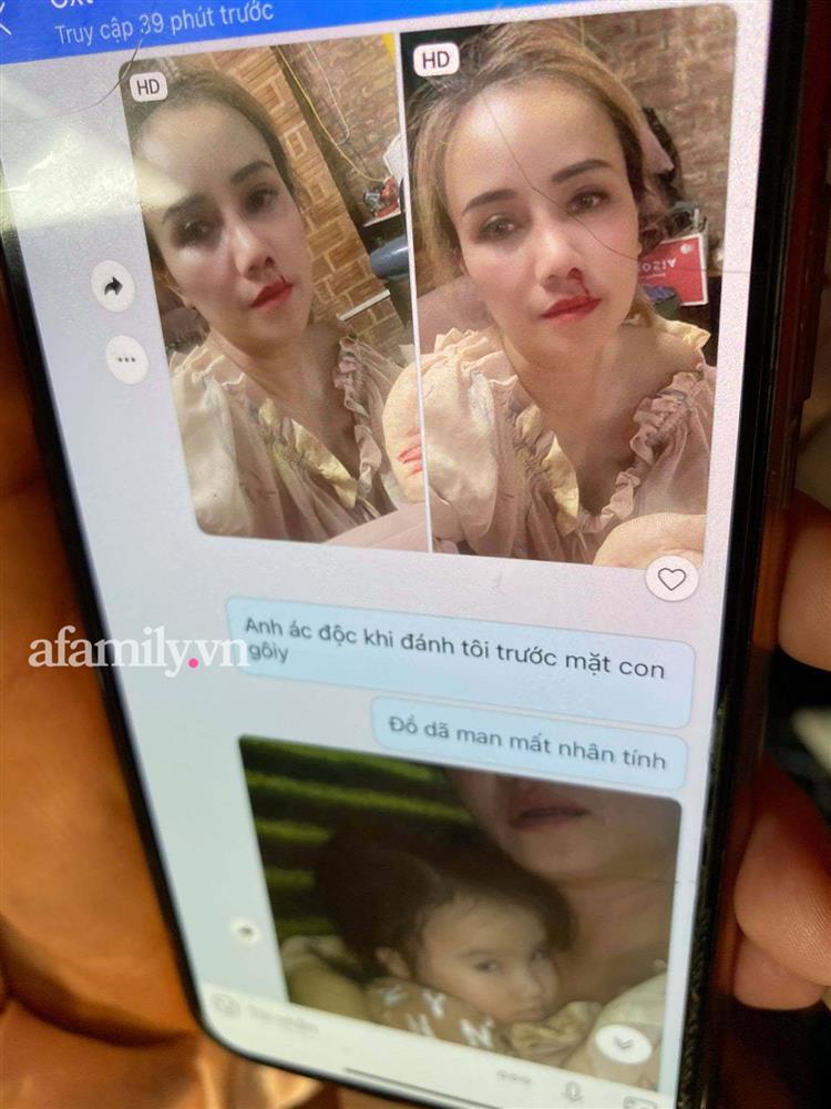 Hé lộ tin nhắn chồng cũ gửi Hoàng Yến sau vụ đấm-2