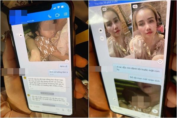 Hoàng Yến đi chữa mũi sau cú đấm trời giáng từ chồng cũ-7