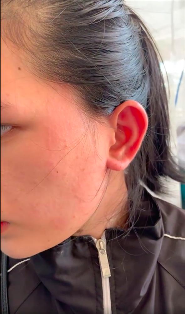 Clip: Vợ bị tát sưng mặt, chồng lao đến chửi bới đòi khô máu-3