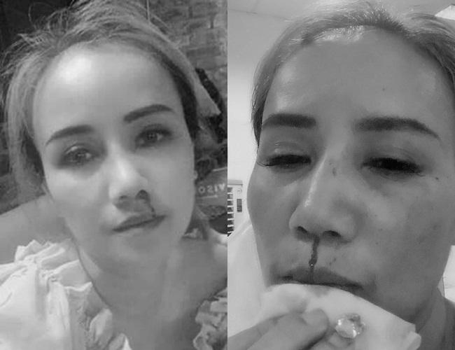 HOT: Chồng cũ xin lỗi vì đấm Hoàng Yến, kể chuyện vợ ngoại tình-6