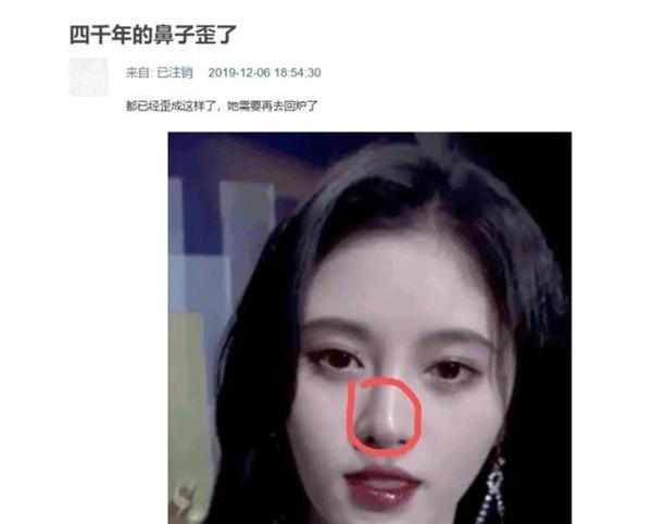 Team qua đường bóc Cúc Tịnh Y: Body thấp bé, sống mũi giả trân-4