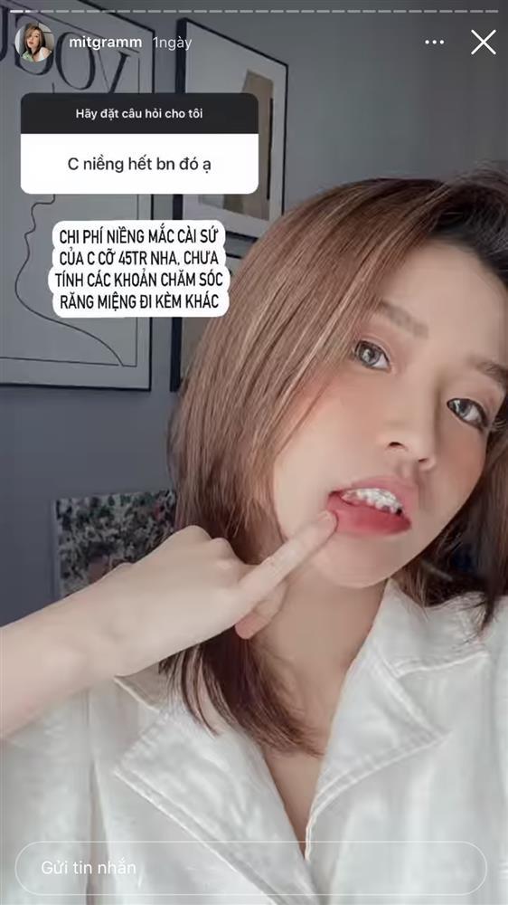 Bà xã Rhymastic khẳng định mũi real nhưng đang sửa bộ phận khác-4