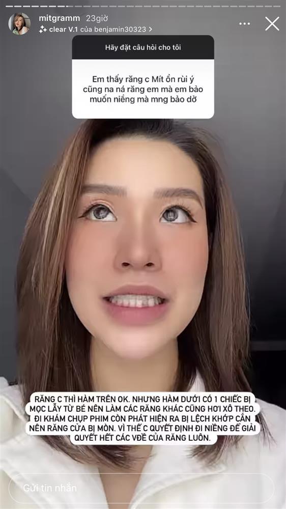 Bà xã Rhymastic khẳng định mũi real nhưng đang sửa bộ phận khác-5