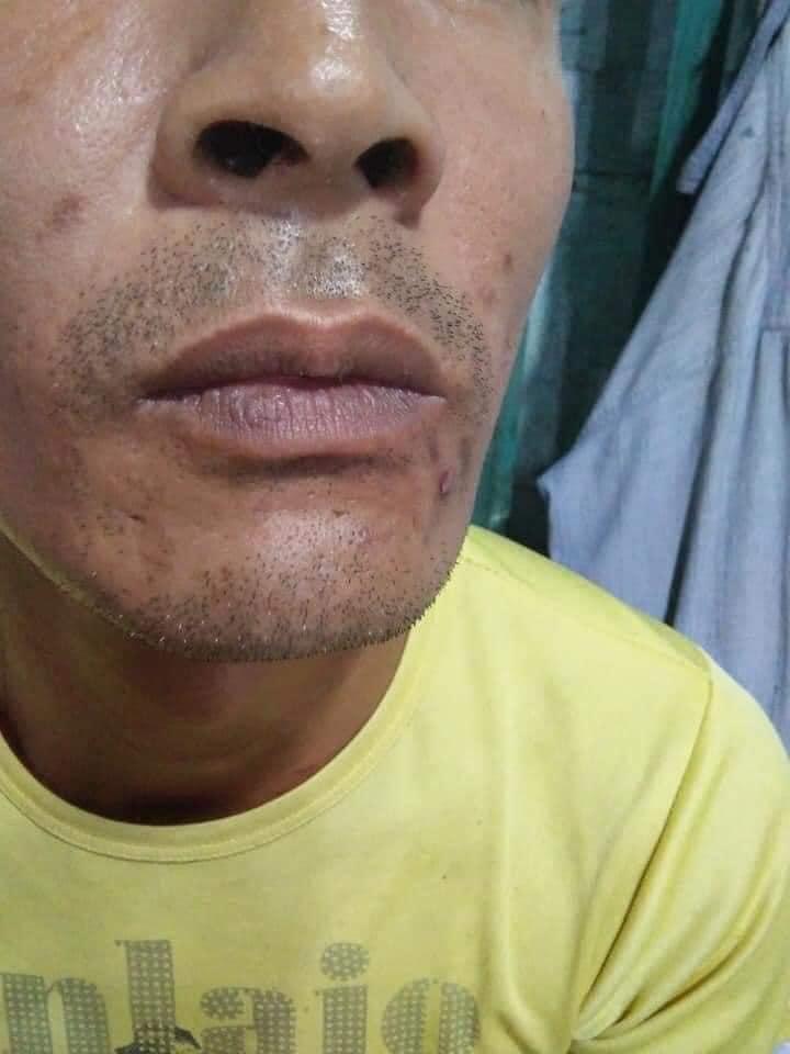 Trốn vợ đi xăm môi khử thâm, ông chú râu rậm rịt, mồm đỏ choét-2