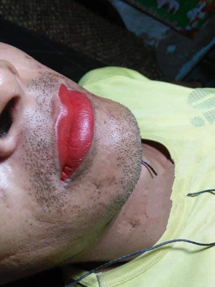 Trốn vợ đi xăm môi khử thâm, ông chú râu rậm rịt, mồm đỏ choét-3