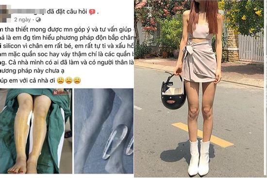 Hết hồn quy trình độn bắp chân silicon dành cho người 'cẳng gà'