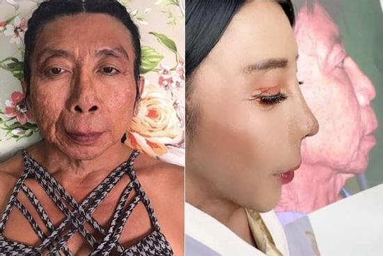 'Gái già chuyển giới' khoe hình sau dao kéo, nhìn mặt giật mình