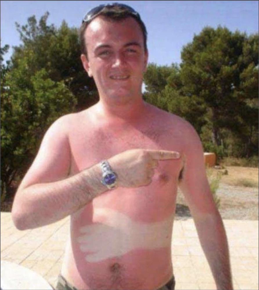 Chiến tích cháy nắng thê lương khiến bạn chỉ muốn ruồng rẫy mùa hè-7