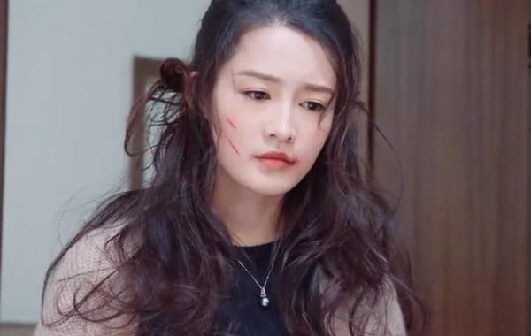 Hải Thượng Phồn Hoa: Lý Thấm mặt bị cào te tua tan nát vẫn đẹp chuẩn visual-1