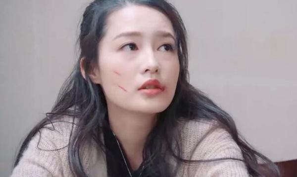 Hải Thượng Phồn Hoa: Lý Thấm mặt bị cào te tua tan nát vẫn đẹp chuẩn visual-5