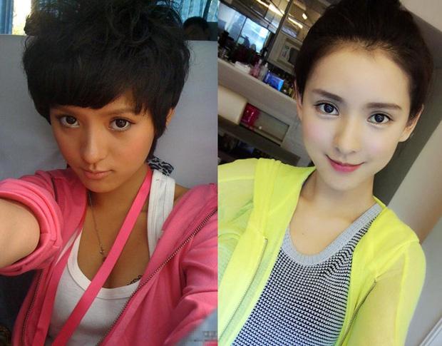 Sao nữ Trung Quốc đẹp nhờ phẫu thuật thẩm mỹ-1