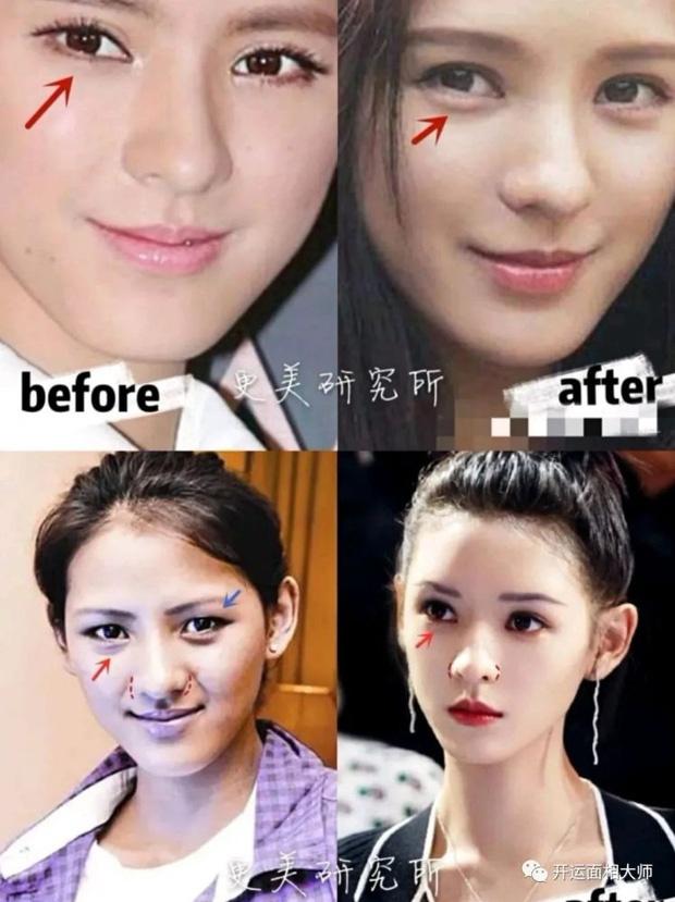 Sao nữ Trung Quốc đẹp nhờ phẫu thuật thẩm mỹ-2
