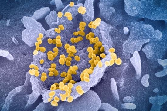 Cảnh báo biến chủng nCoV mới có thể kháng vaccine Covid-19